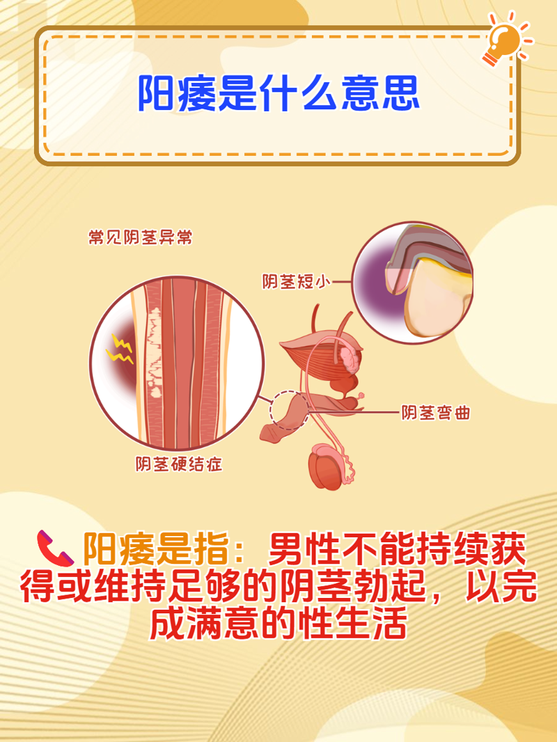 性功能障碍包括哪些症状?这是一个让许多男性朋友困扰不已的问题。