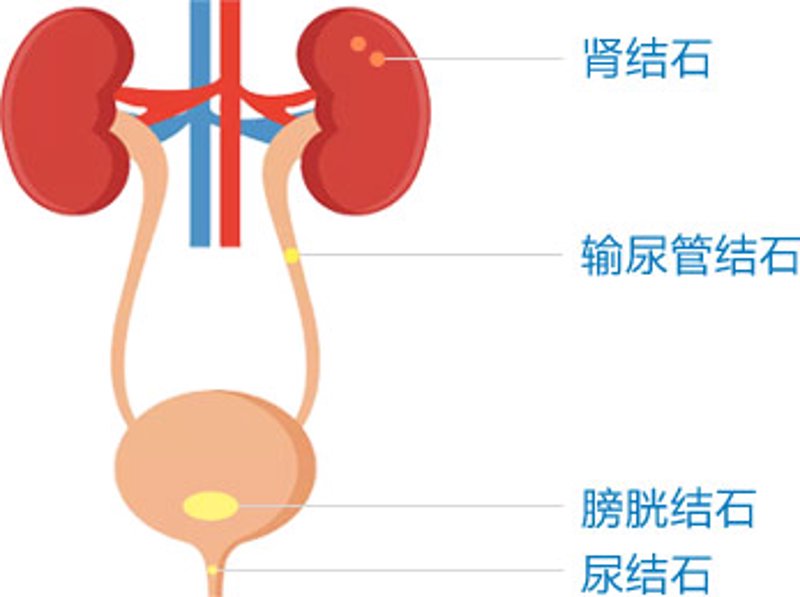 前列腺炎吃什么药可以根治?这是一个让不少男性朋友头疼的问题。