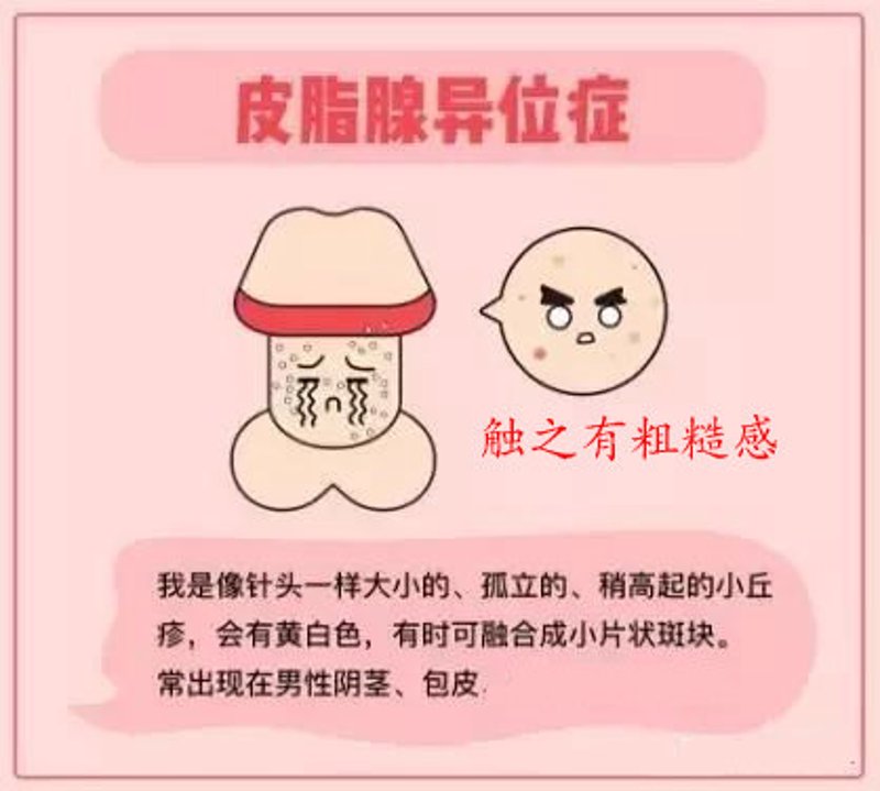 性功能障碍到底包括哪些症状?男性朋友们,你们了解吗?今天我们就来聊聊这个话题。