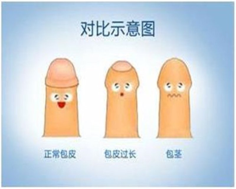 男科体检应该挂哪个科室？前列腺健康，这个问题常常让男性朋友们感到困惑。今天，我们就来详细解答。