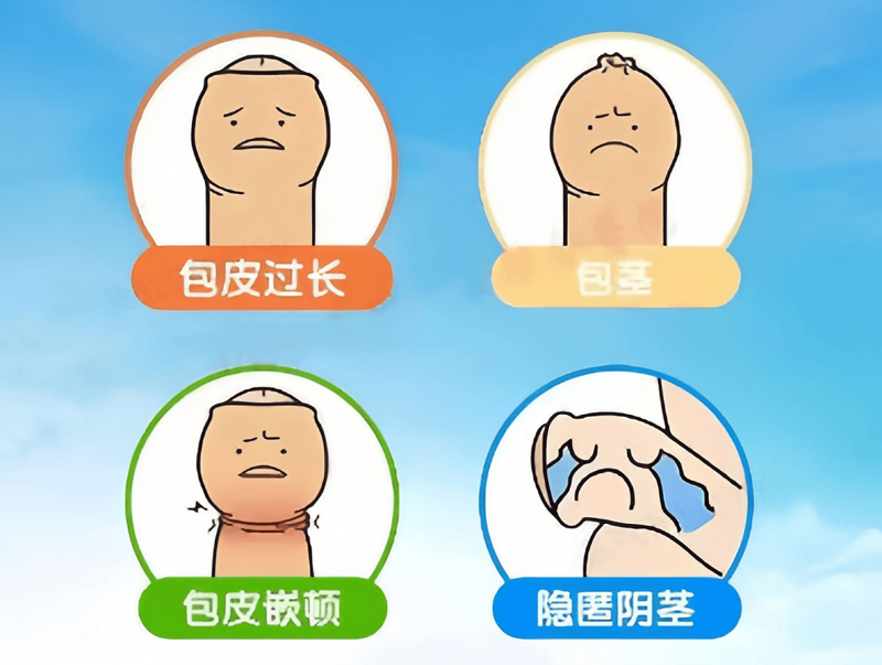 包皮包茎